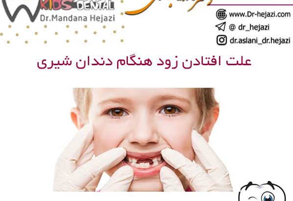 علت افتادن زود هنگام دندان شیری