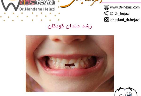 رشد دندان کودکان
