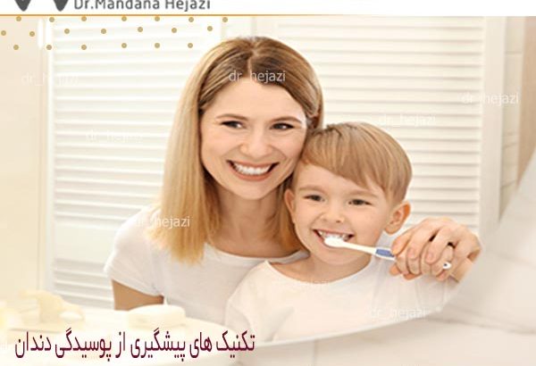 تکنیک های پیشگیری از پوسیدگی دندان - دکتر حجازی