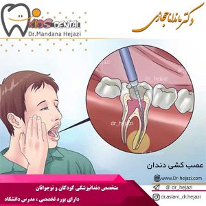 عصب کشی دندان - دکتر حجازی