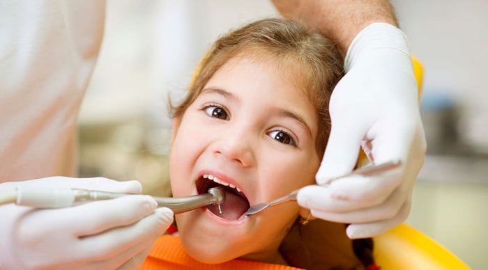 روکش دندان شیری در کودکان
